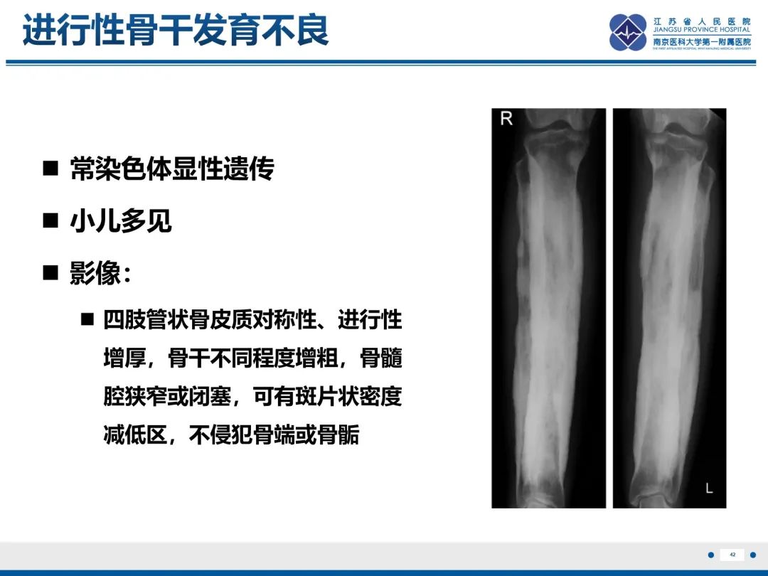 影像PPT - 【PPT】Erdheim-Chester病-43