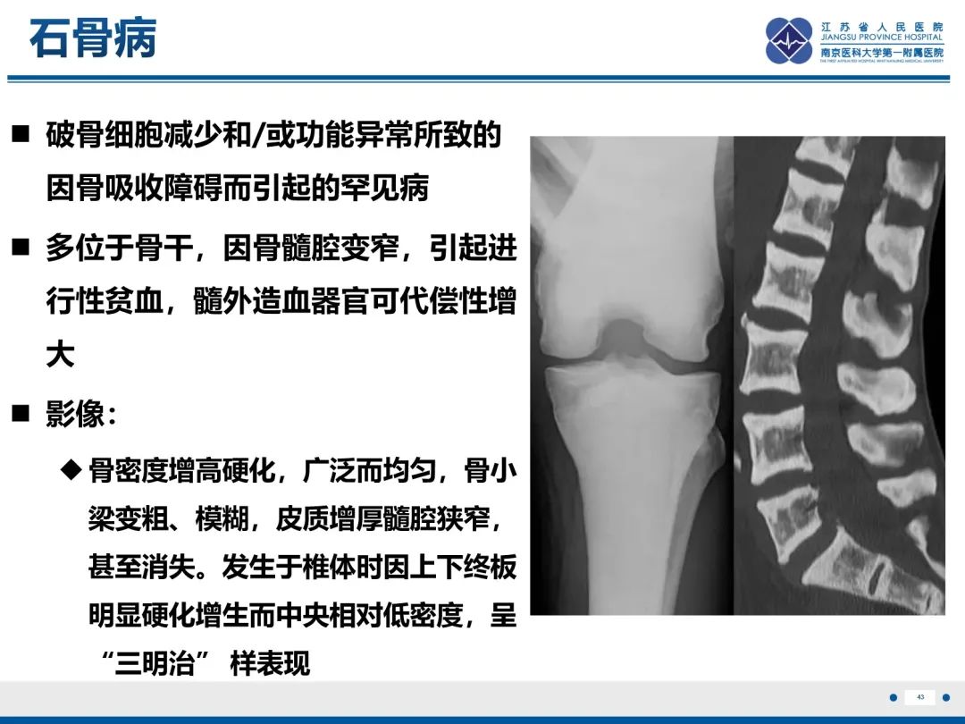 影像PPT - 【PPT】Erdheim-Chester病-44