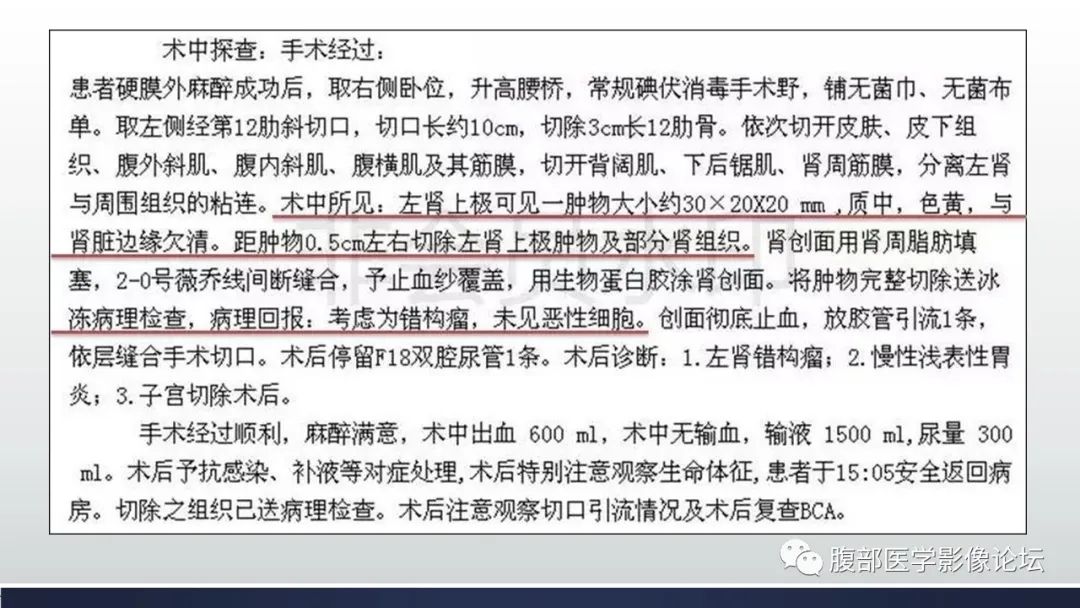 影像PPT - 【病例】肾脏神经鞘瘤1例CT影像-7