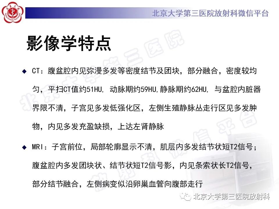 影像PPT - 【PPT】静脉内平滑肌瘤病-5