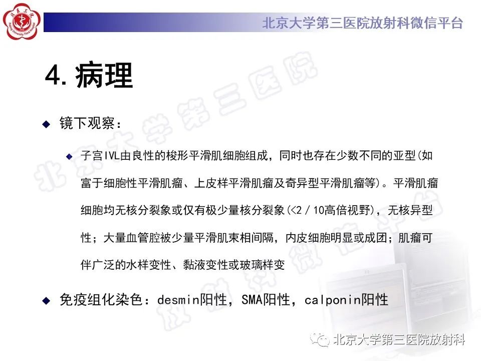 影像PPT - 【PPT】静脉内平滑肌瘤病-14
