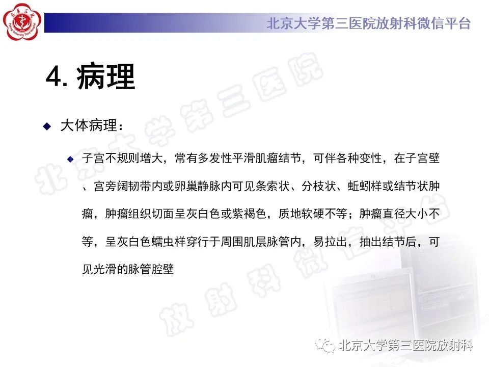 影像PPT - 【PPT】静脉内平滑肌瘤病-13