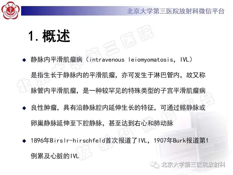 影像PPT - 【PPT】静脉内平滑肌瘤病-1