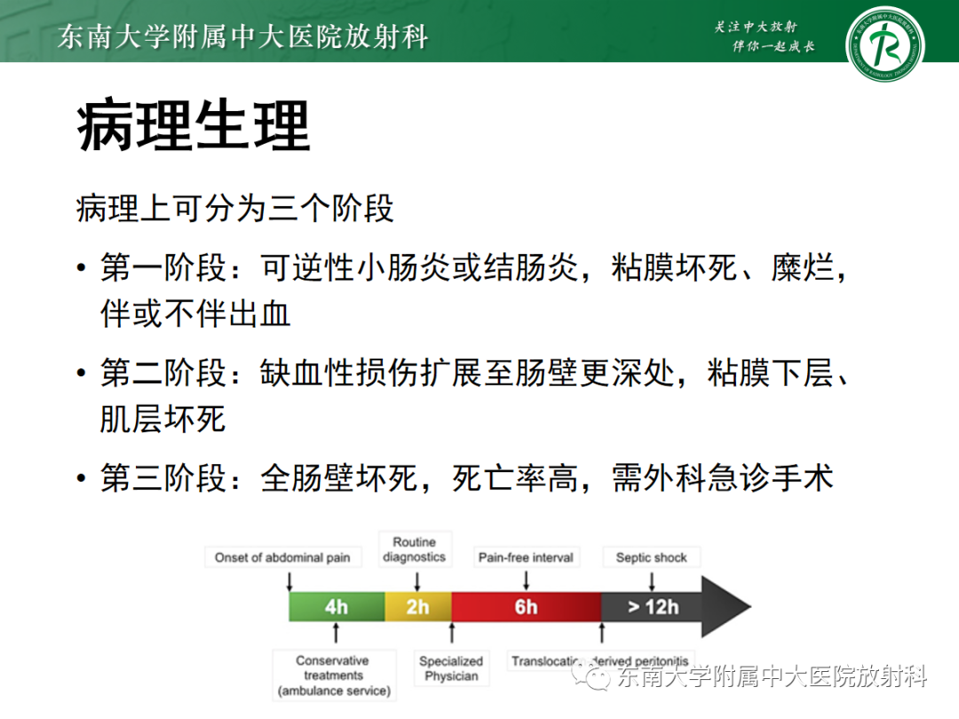 影像PPT - 【PPT】急性肠系膜缺血-7 影像PPT - 【PPT】急性肠系膜缺血-7