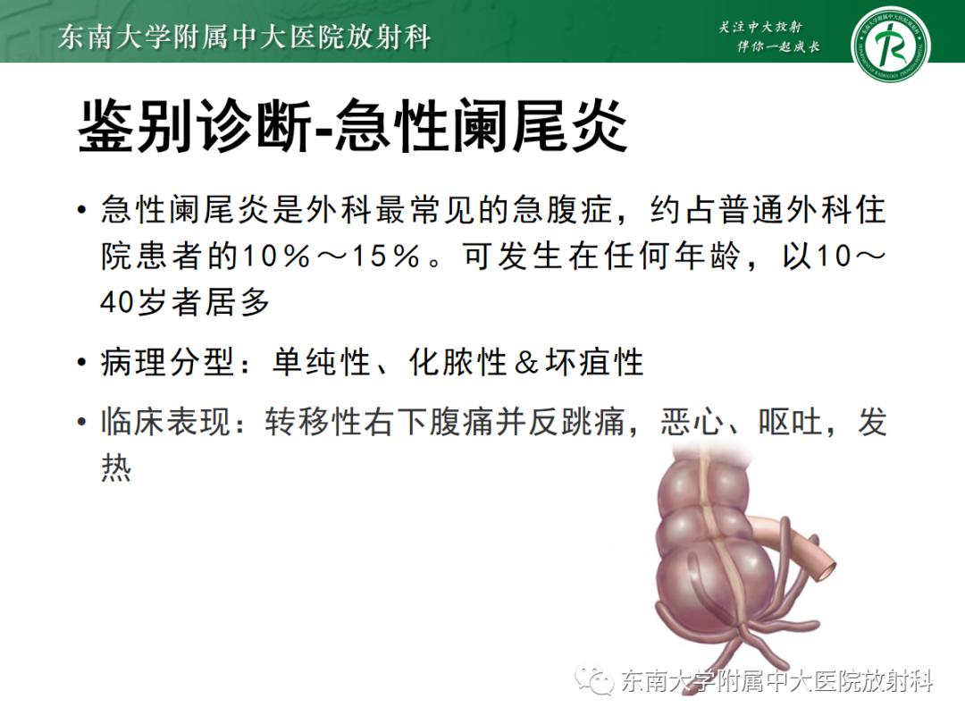 影像PPT - 【PPT】急性肠系膜缺血-22 影像PPT - 【PPT】急性肠系膜缺血-22