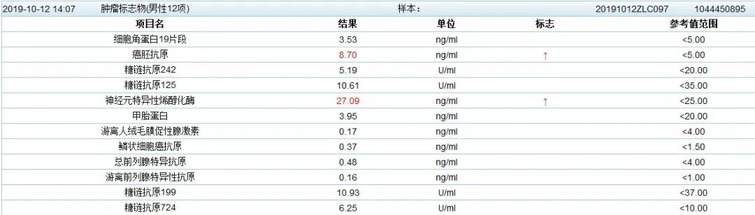影像PPT - 中央型小细胞肺癌CT与病理对照-9 影像PPT - 中央型小细胞肺癌CT与病理对照-9