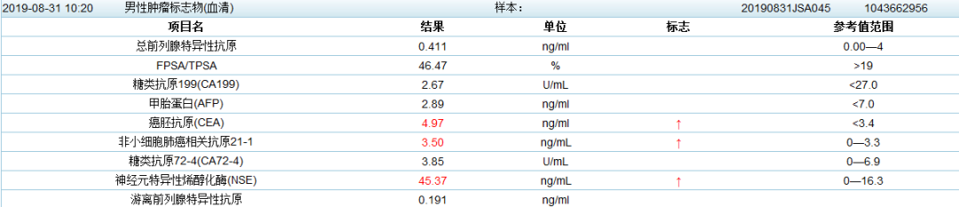 影像PPT - 中央型小细胞肺癌CT与病理对照-5 影像PPT - 中央型小细胞肺癌CT与病理对照-5