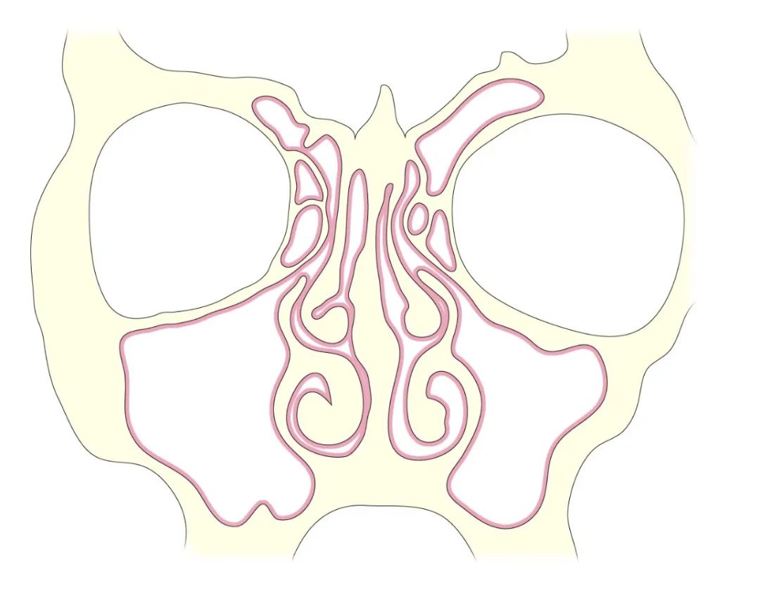 影像PPT - 【病例】鼻窦粘液囊肿1例MR影像-8 影像PPT - 【病例】鼻窦粘液囊肿1例MR影像-8