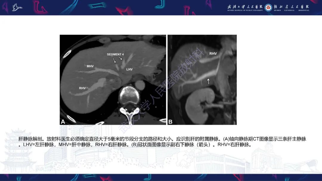 影像PPT - 【PPT】二步肝切除术CT评估-19