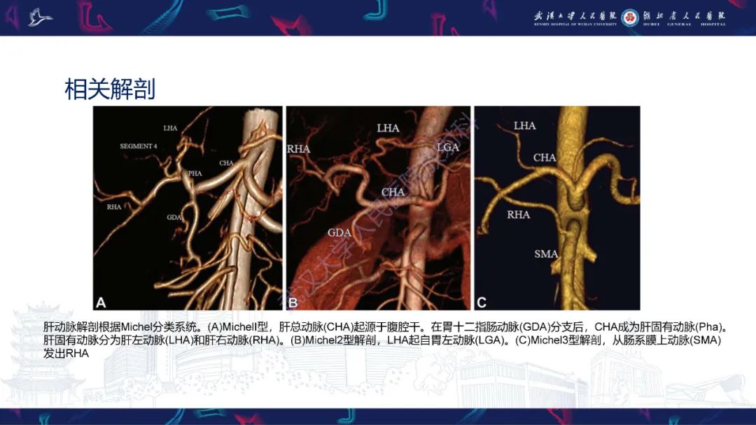 影像PPT - 【PPT】二步肝切除术CT评估-17