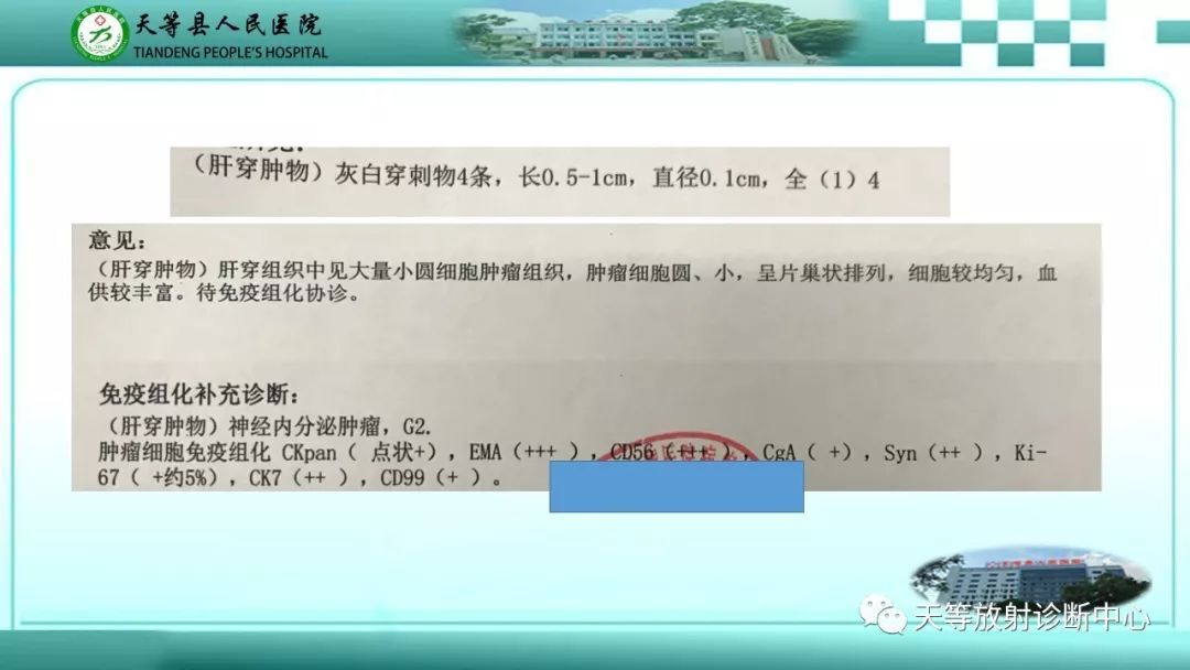 影像PPT - 【PPT】胰腺内分泌肿瘤-14