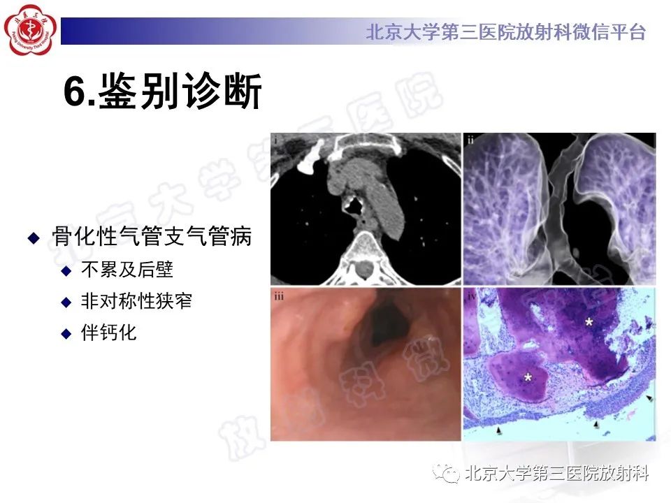 影像PPT - 【PPT】复发性多软骨炎-18