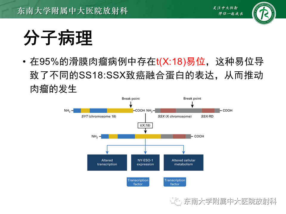 影像PPT - 【PPT】膝关节滑膜肉瘤-7 影像PPT - 【PPT】膝关节滑膜肉瘤-7