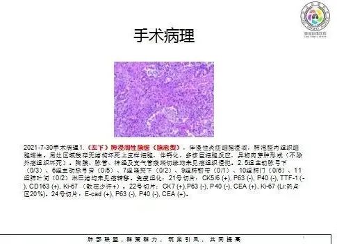 影像PPT - 【病例】肺门区团块影1例分析思路-27 影像PPT - 【病例】肺门区团块影1例分析思路-27