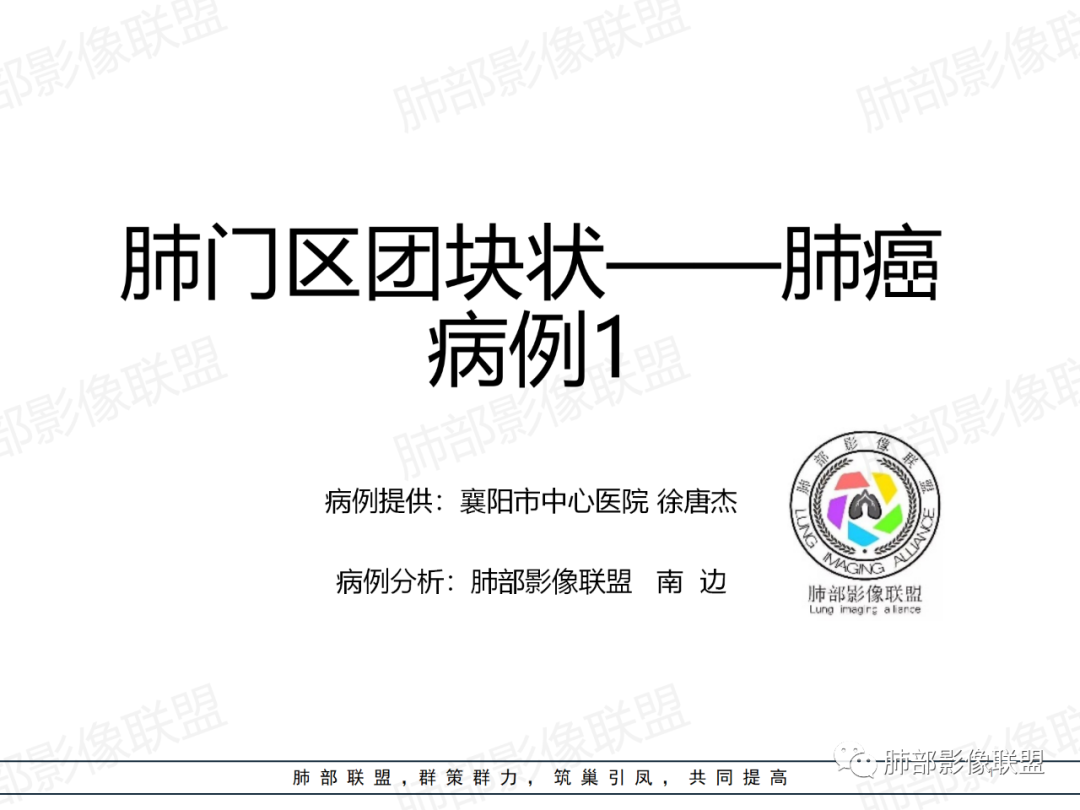 影像PPT - 【病例】肺门区团块影1例分析思路-28 影像PPT - 【病例】肺门区团块影1例分析思路-28