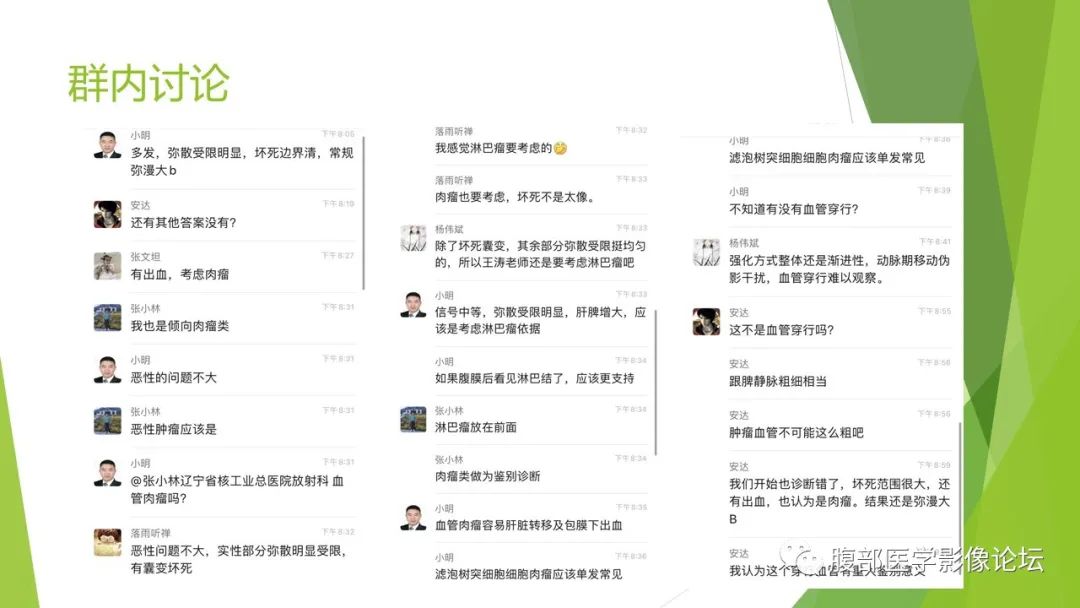 影像PPT - 【病例】脾脏弥漫大B细胞淋巴瘤1例CT及MR影像-28