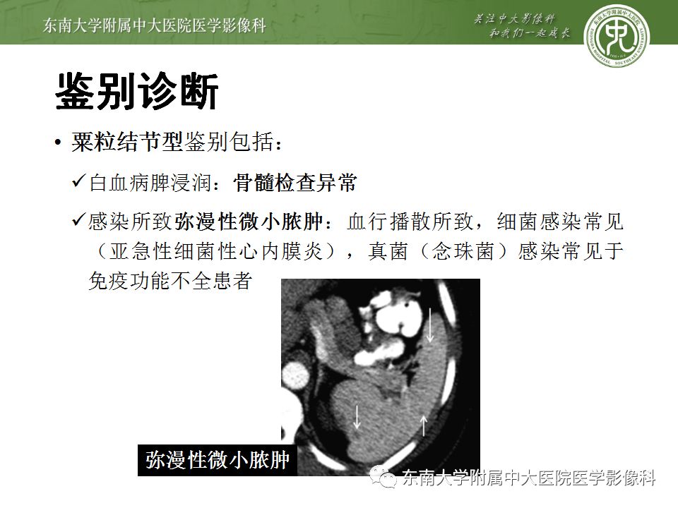 影像PPT - 【病例】脾脏弥漫大B细胞淋巴瘤1例CT及MR影像-36
