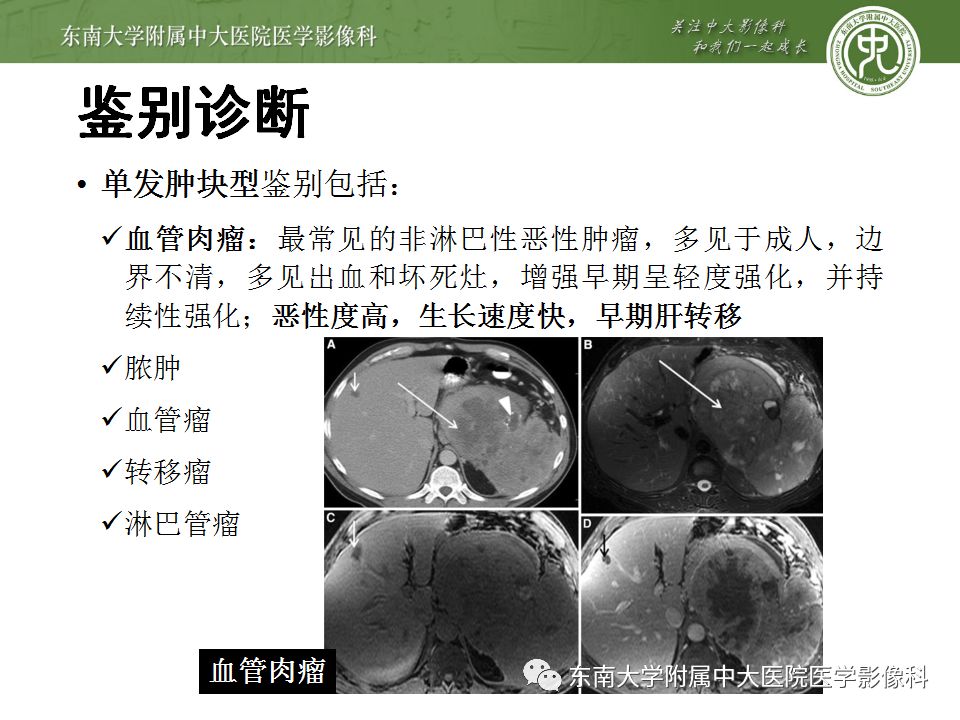 影像PPT - 【病例】脾脏弥漫大B细胞淋巴瘤1例CT及MR影像-38
