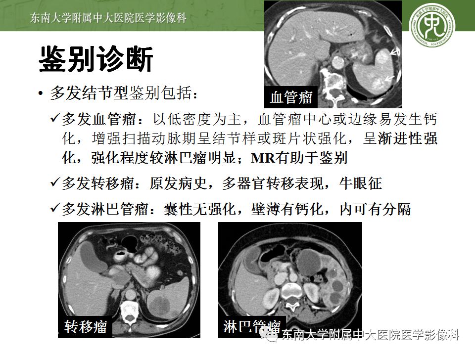 影像PPT - 【病例】脾脏弥漫大B细胞淋巴瘤1例CT及MR影像-37