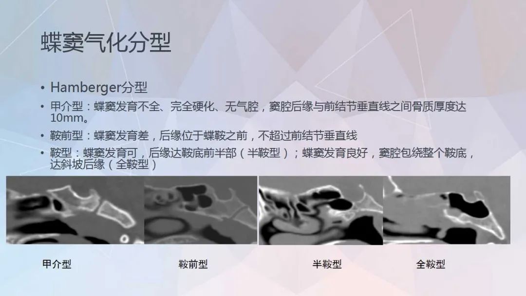 影像PPT - 【PPT】鼻窦CT评估与结构式报告-13