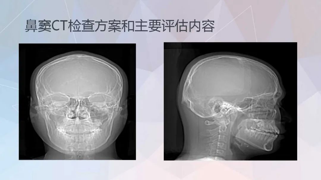 影像PPT - 【PPT】鼻窦CT评估与结构式报告-6