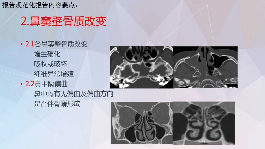 影像PPT - 【PPT】鼻窦CT评估与结构式报告-19
