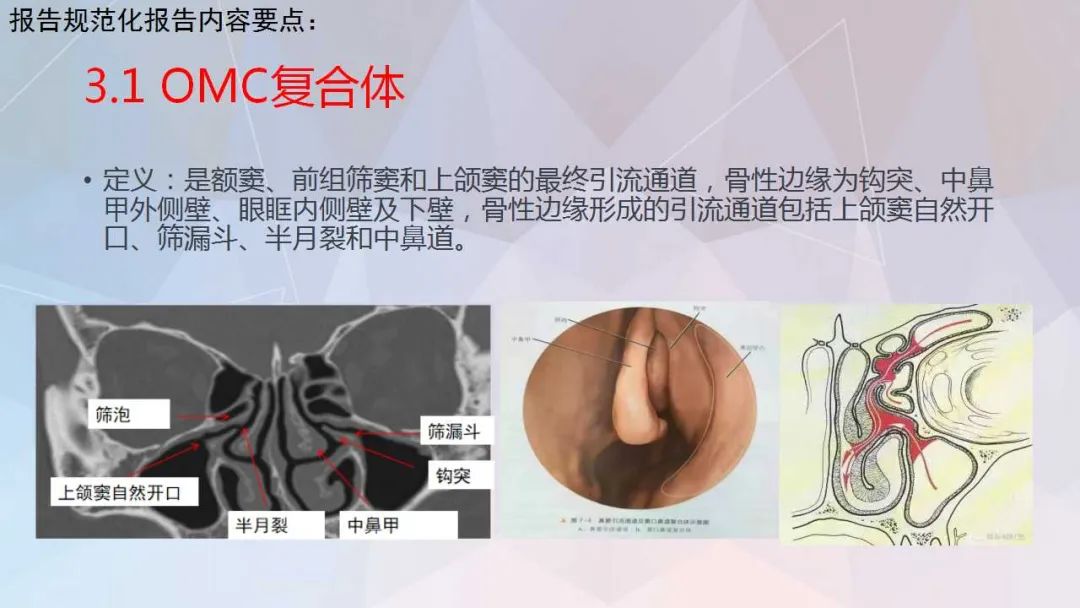 影像PPT - 【PPT】鼻窦CT评估与结构式报告-21