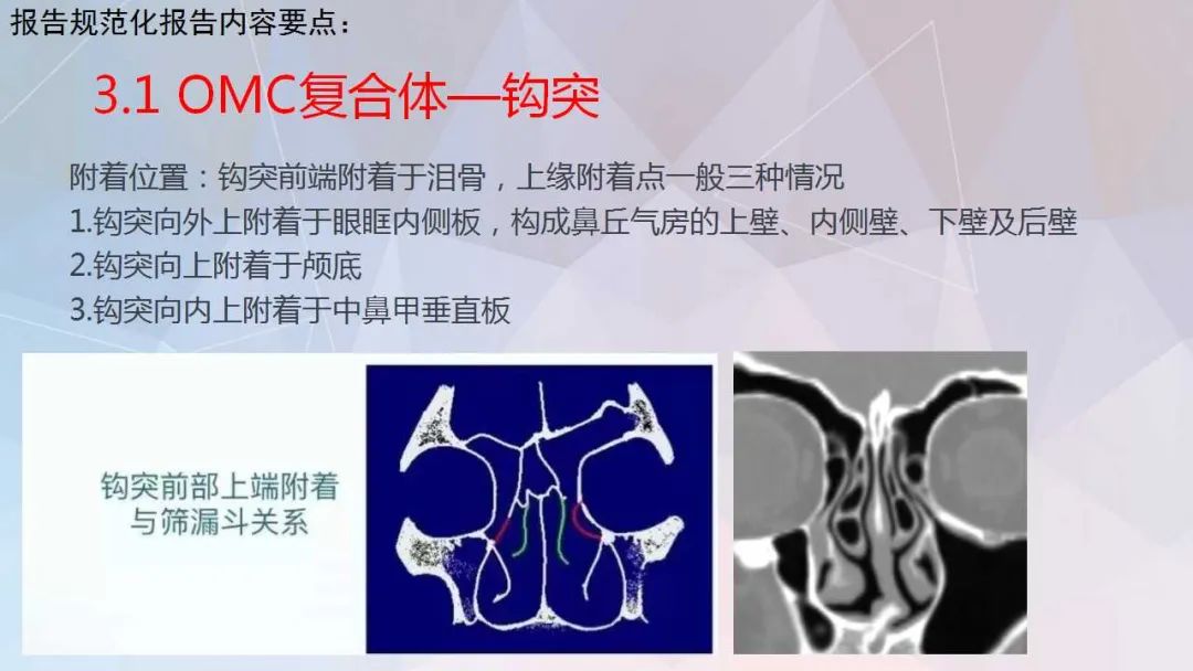 影像PPT - 【PPT】鼻窦CT评估与结构式报告-26