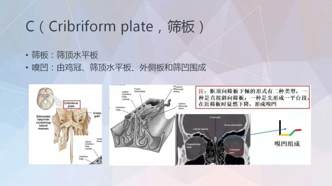 影像PPT - 【PPT】鼻窦CT评估与结构式报告-35