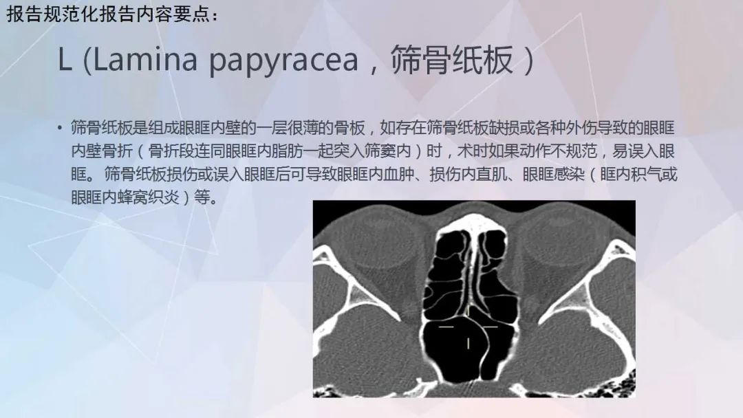 影像PPT - 【PPT】鼻窦CT评估与结构式报告-37