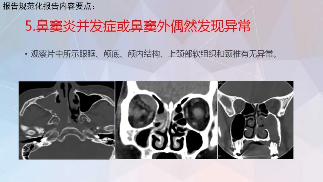 影像PPT - 【PPT】鼻窦CT评估与结构式报告-44