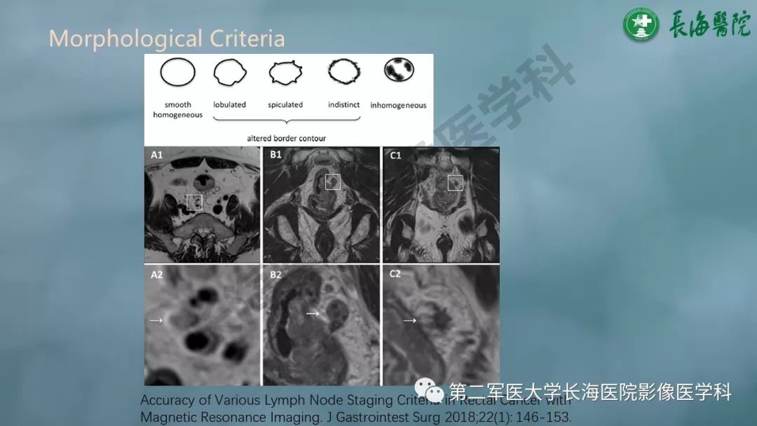 影像PPT - 【PPT】CRC淋巴结良恶性评估-9