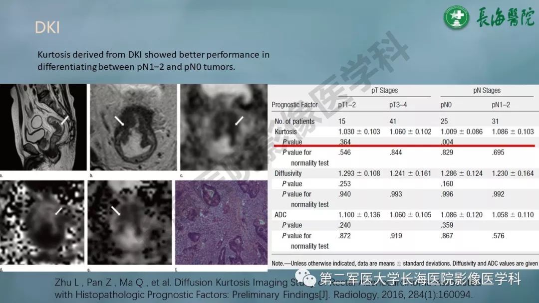 影像PPT - 【PPT】CRC淋巴结良恶性评估-18
