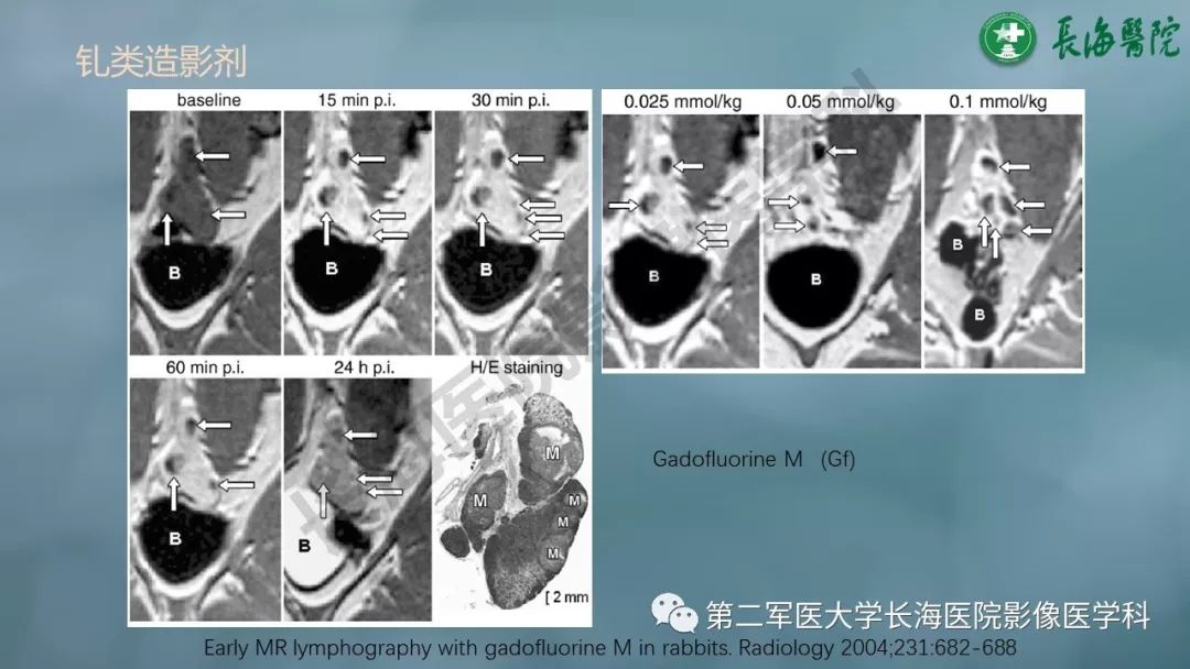 影像PPT - 【PPT】CRC淋巴结良恶性评估-23