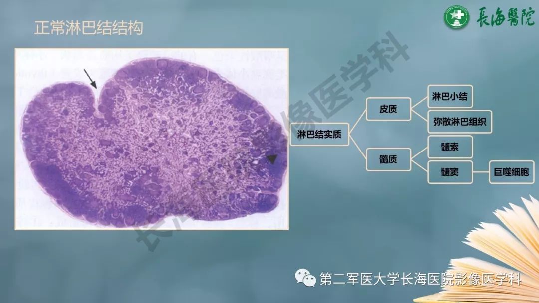 影像PPT - 【PPT】CRC淋巴结良恶性评估-5