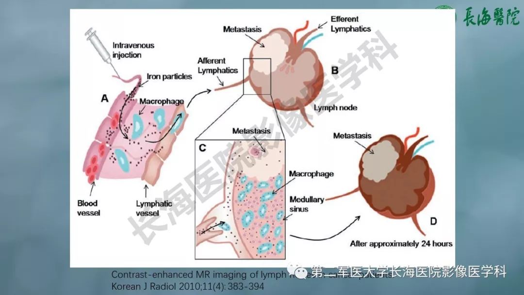 影像PPT - 【PPT】CRC淋巴结良恶性评估-25