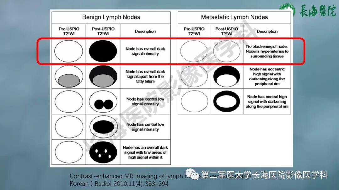 影像PPT - 【PPT】CRC淋巴结良恶性评估-31