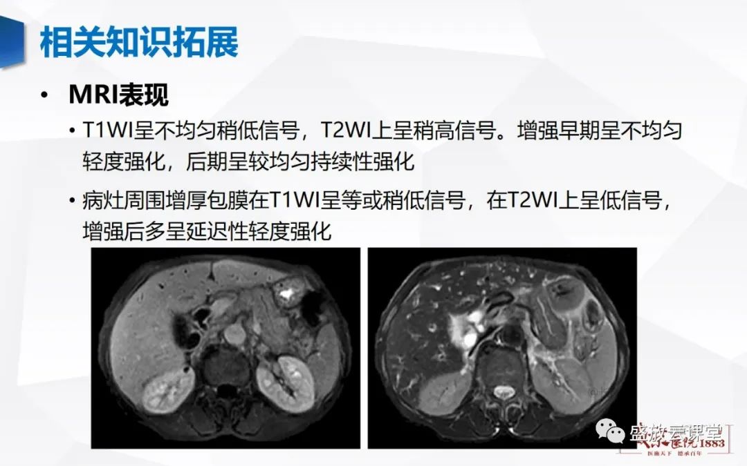影像PPT - 【PPT】胰腺病变（胰腺炎）-25