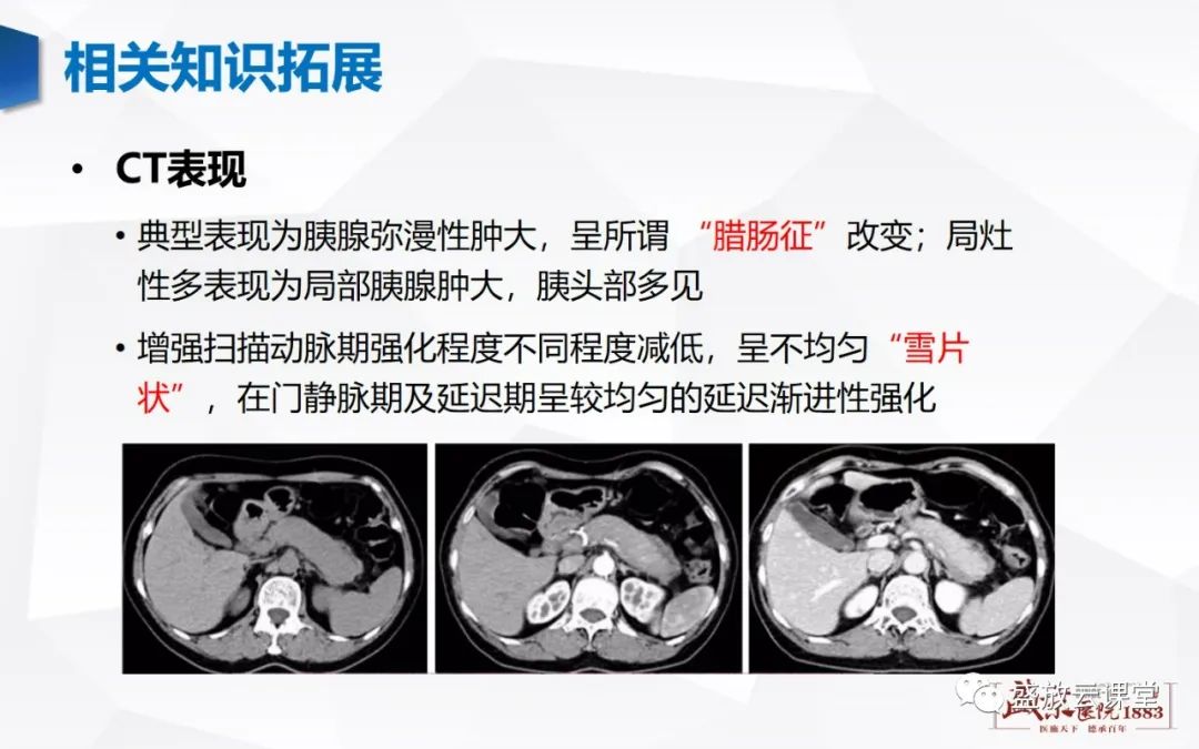 影像PPT - 【PPT】胰腺病变（胰腺炎）-22