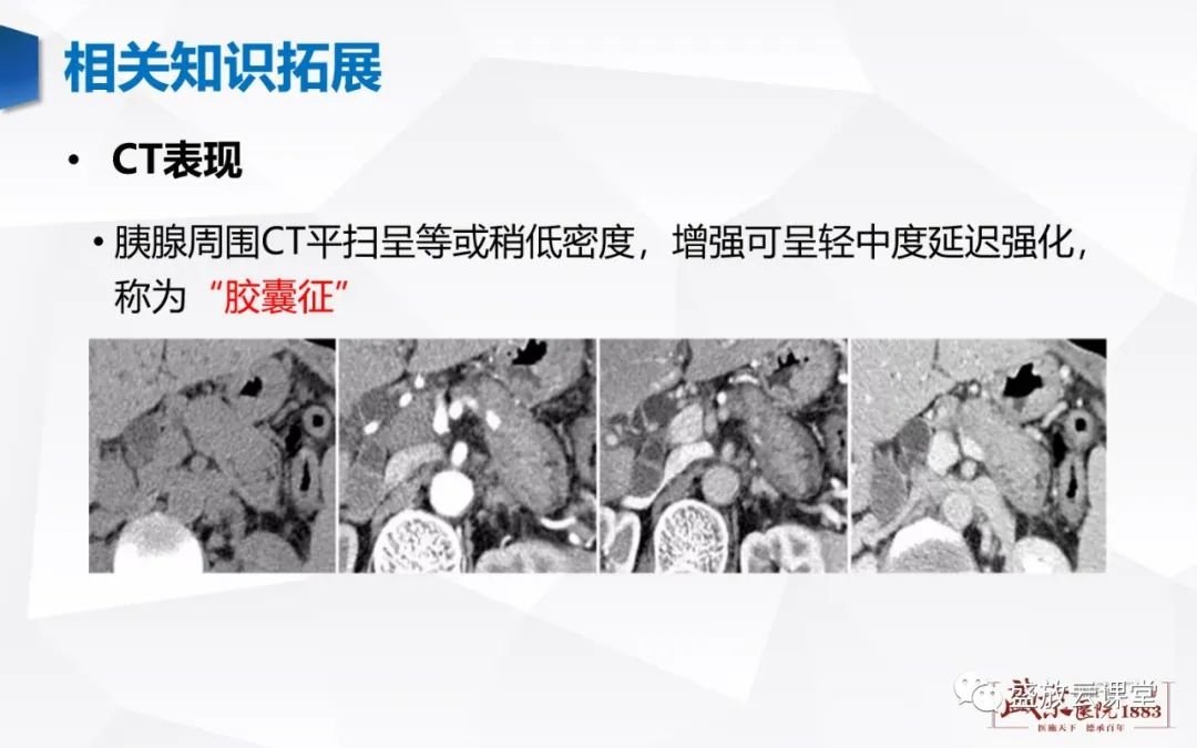 影像PPT - 【PPT】胰腺病变（胰腺炎）-23