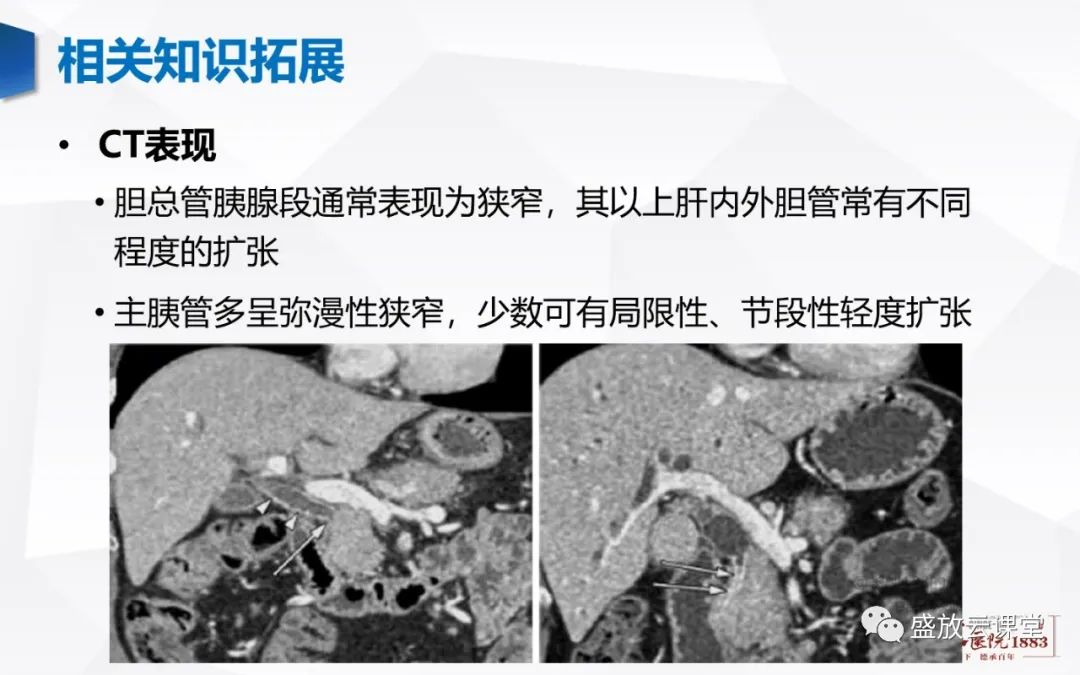 影像PPT - 【PPT】胰腺病变（胰腺炎）-24