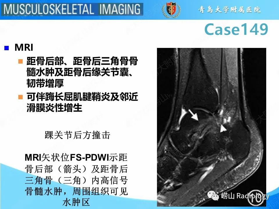 影像PPT - 【PPT】三角骨综合征-8