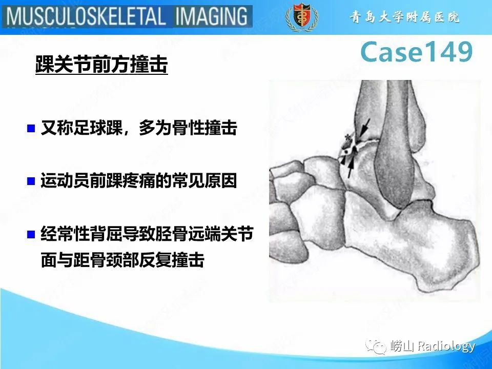 影像PPT - 【PPT】三角骨综合征-20