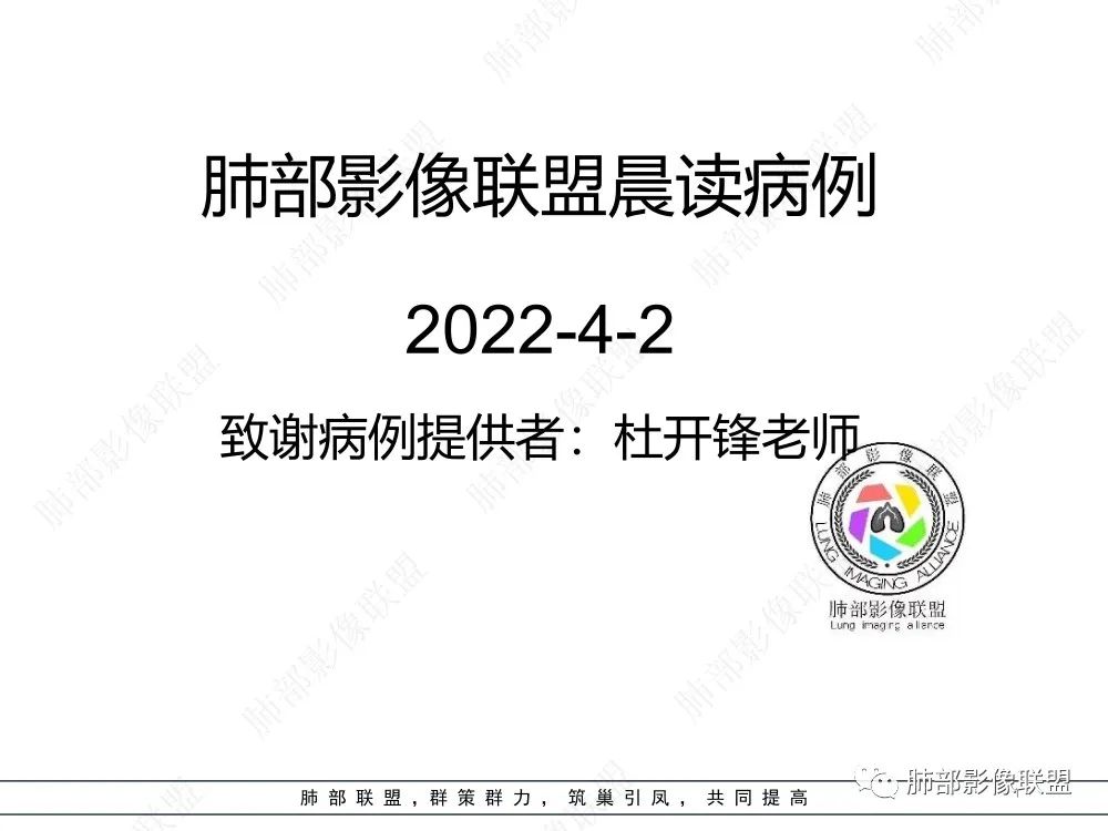 影像PPT - 【每日晨读】如此结核,无愧“妖中之王”!-1 影像PPT - 【每日晨读】如此结核,无愧“妖中之王”!-1