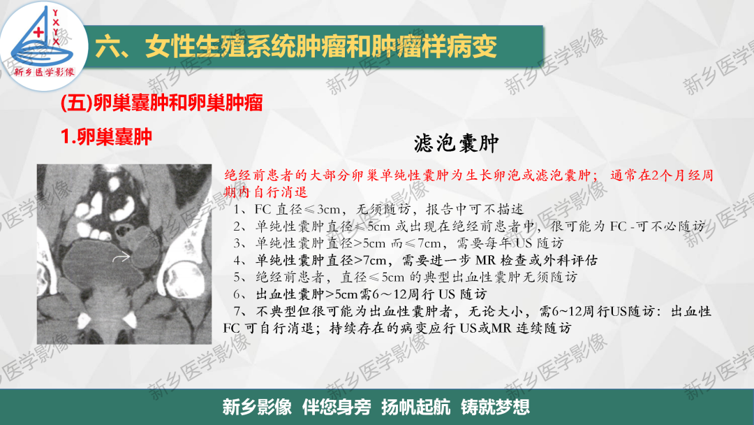 影像PPT - 【PPT】卵巢肿瘤的影像表现-5