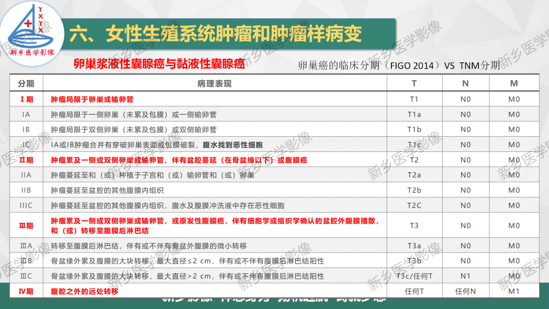 影像PPT - 【PPT】卵巢肿瘤的影像表现-25
