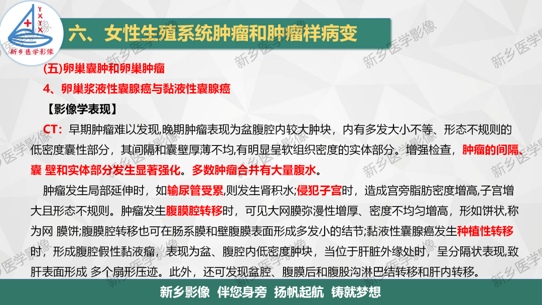 影像PPT - 【PPT】卵巢肿瘤的影像表现-21