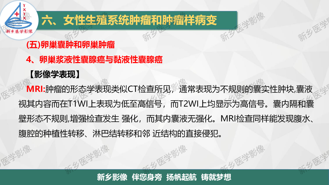 影像PPT - 【PPT】卵巢肿瘤的影像表现-23