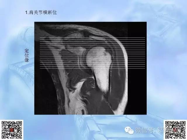 影像PPT - 【PPT】肩关节解剖-11
