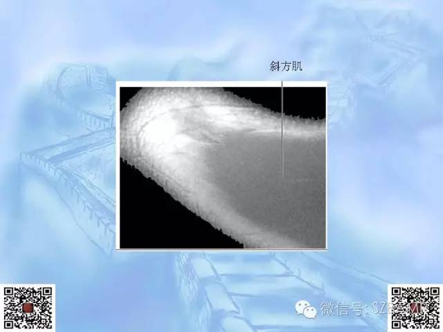 影像PPT - 【PPT】肩关节解剖-12